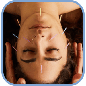 Acupuntura estética Facial - Sesión 1 Hora