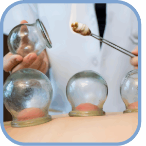 Masajes Con Ventosas (Cupping)
